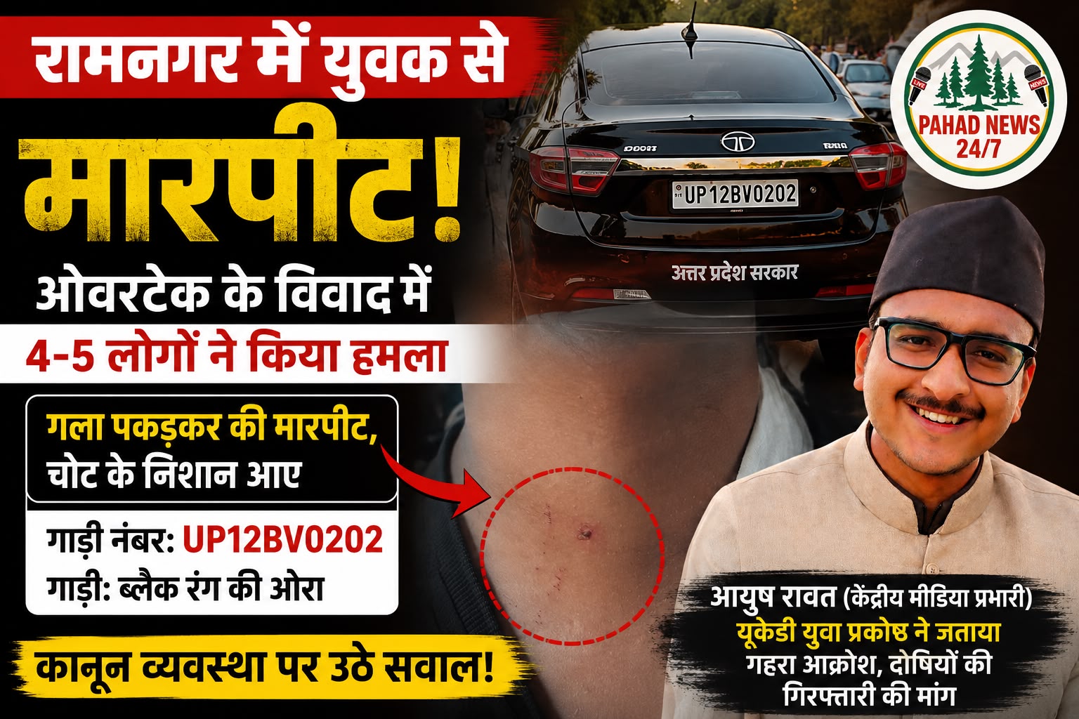 रामनगर में युवक से मारपीट का आरोप, ‘उत्तर प्रदेश सरकार’ लिखी कार में सवार लोगों पर गंभीर आरोप; यूकेडी नेता आयुष रावत ने जताया आक्रोश